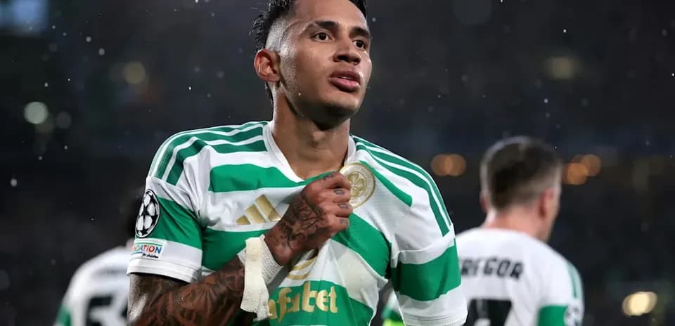 Jugador de Celtic mostrando su camiseta durante el partido