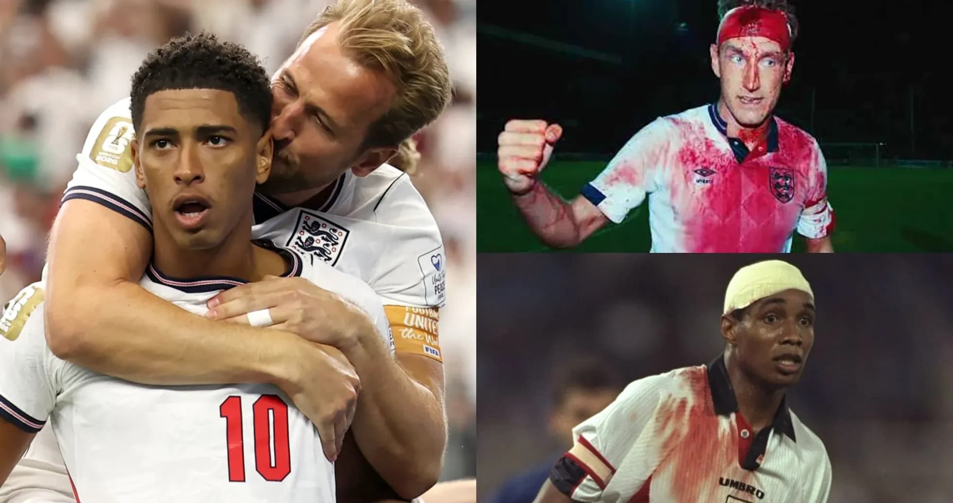 Jugadores de Inglaterra en momentos de acción y lesión